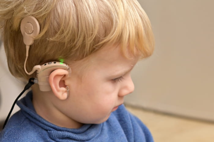 Impianto cocleare: dalla selezione del paziente alla riabilitazione uditiva