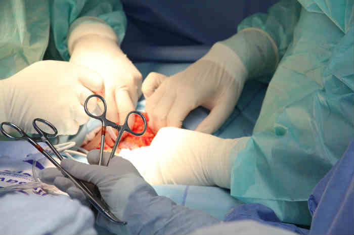 operazione chirurgica