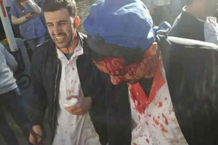 Algeria, medici picchiati a sangue dalla polizia