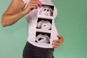 Rischi e complicanze della gravidanza multipla