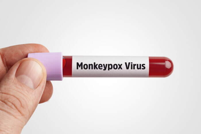 Monkeypox, il vaiolo delle scimmie