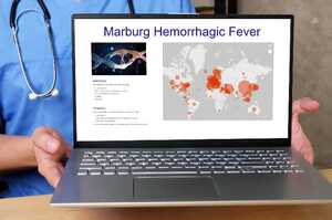 Febbre emorragica di Marburg