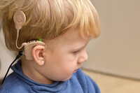 Impianto cocleare: dalla selezione del paziente alla riabilitazione uditiva