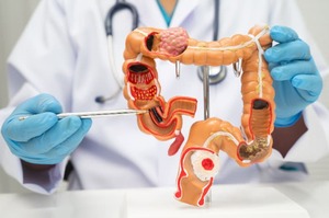 Screening del tumore del colon-retto: chi deve farlo e perché è decisivo