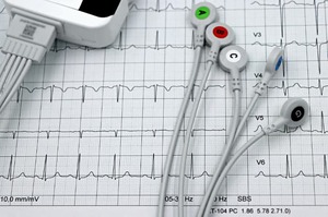 Infarto negli over 65 fragili: ricoveri ridotti del 43% in Emilia-Romagna