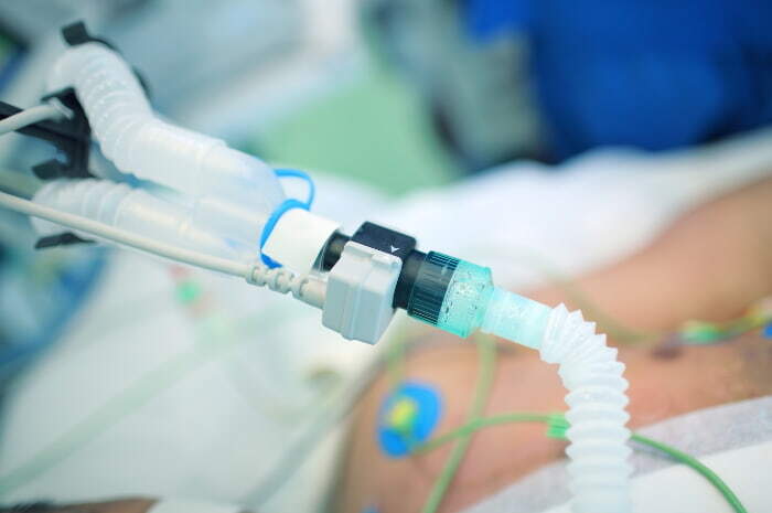 Cure mancate in terapia intensiva: validata in Italia la scala MINCS-IT