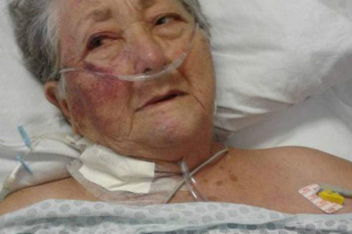 Brasile, 78enne muore dopo le percosse di un infermiere